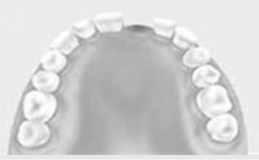 澳門植牙邊間好