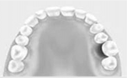 澳門植牙牙醫介紹